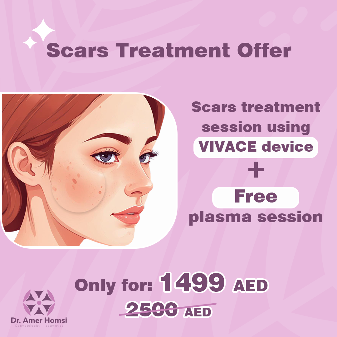 scars en